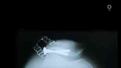 Magnetresonanztomografie kostenlos streamen | dailyme