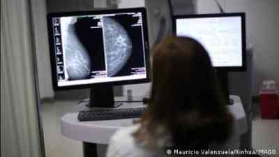 How AI is expanding breast cancer screening in Mexico kostenlos streamen | dailyme