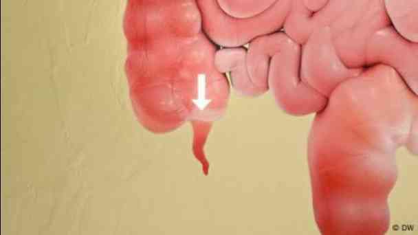 The appendix: Useless organ or gut health hero? kostenlos streamen | dailyme