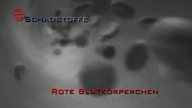 Woher kommen Augenringe?