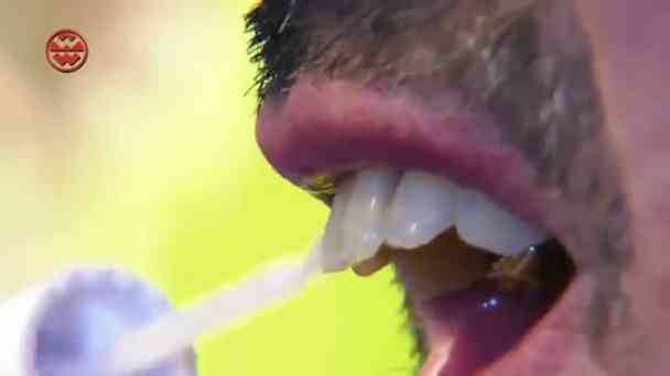 Zahn-Weißmacher im Vorher-Nachher-Test kostenlos streamen | dailyme