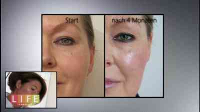 4.2 - Lebensmittellügen, Anti-Aging Cremes im Test | Life Goes On kostenlos streamen | dailyme