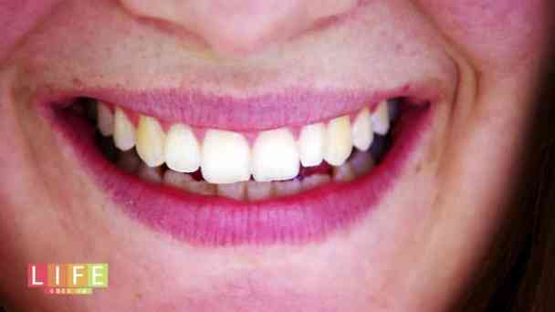 13.3 - Wie werden Zähne strahlend weiß? | Life Goes On kostenlos streamen | dailyme