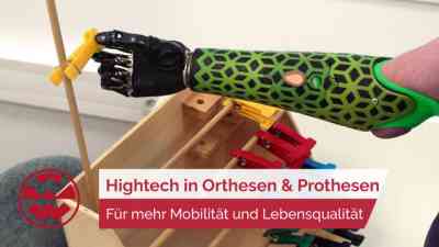 So viel Hightech steckt in orthopädietechnischen Hilfsmitteln | Life Goes On kostenlos streamen | dailyme